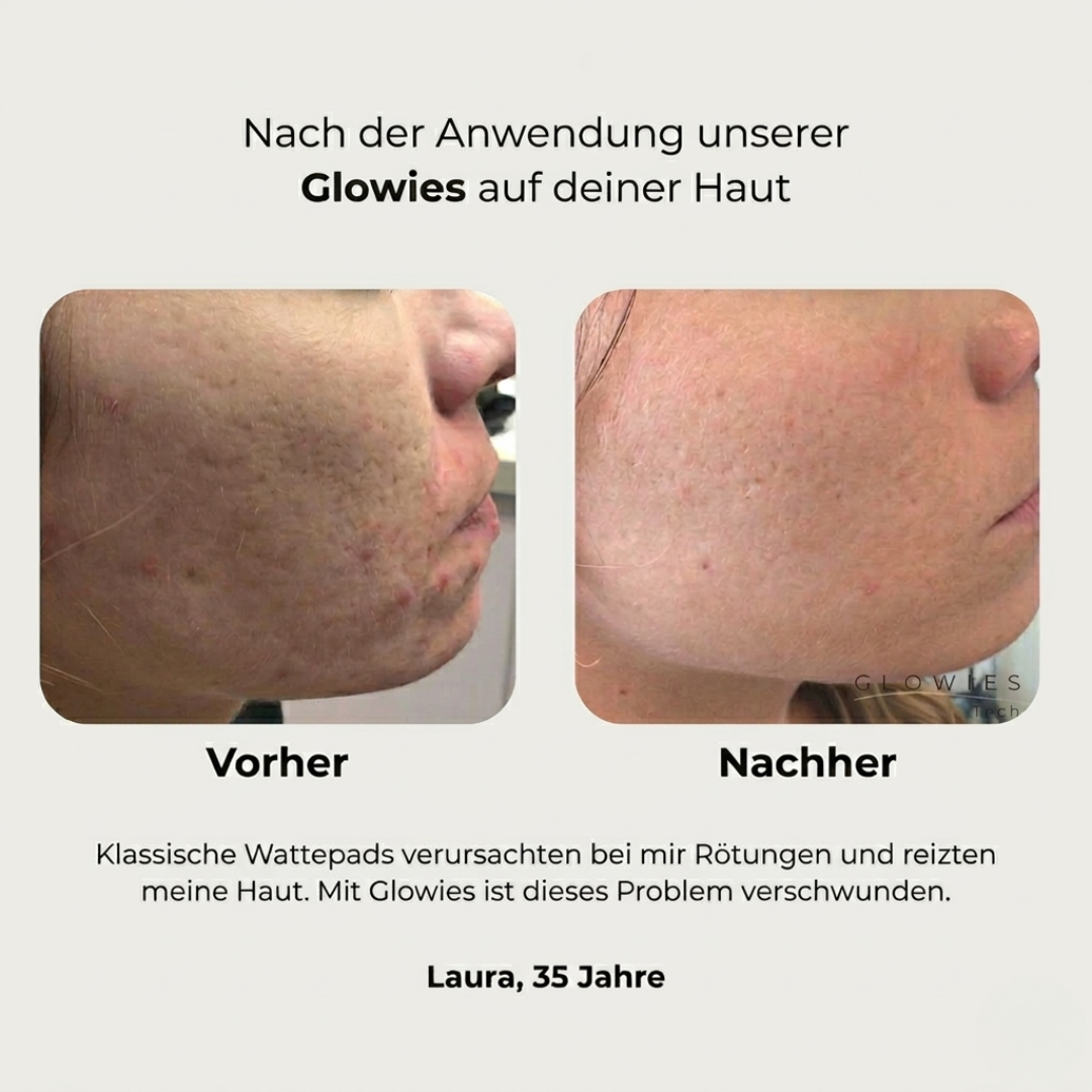 Melaras Abschminkhandschuhe